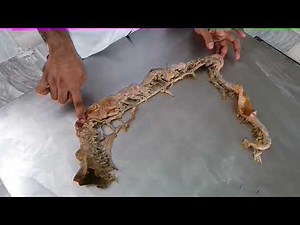 Large Intestine || Anatomy Episode 6