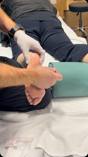 Dry needling being applied to the plantar fascia. Dry needling can be an effective treatment for plantar fasciitis by targeting trigger points in the muscles of the foot and calf, reducing pain and improving mobility. It involves inserting thin needles into these points to stimulate a local twitch response, which can relax muscles, reduce tension, and promote healing. While some individuals may experience immediate relief after a single session, multiple sessions are often recommended for optima