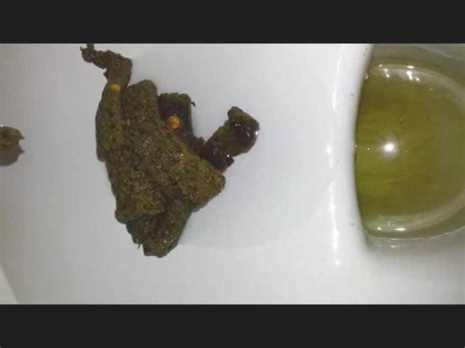Big poop - video 15