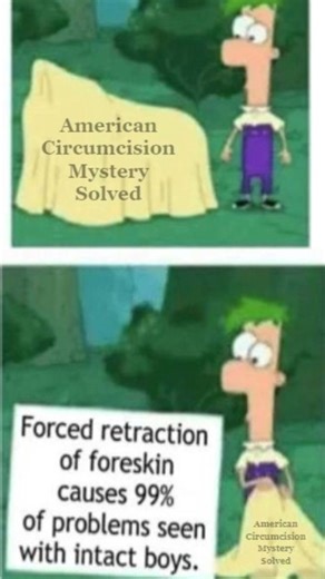 Forced retraction is the cause of most problems seen with intact boys. How to care for your son’s intact penis: Just wash off the outside and never forcibly retract the foreskin. An external wipe during diaper changes and a dip in a warm bath is all that's needed. In childhood the foreskin membrane gradually dissolves and separates from the glans. Then he can rinse underneath with water only -- no soap which can cause irritation and other problems. | Bloodstained Men & Their Friends