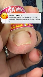 11K views · 187 reactions | Nấm móng . dưỡng móng . dụng cụ lấy khoé c lấy gì e tư vấn cho ạ | Bích Liên Hoa Sen | Facebook