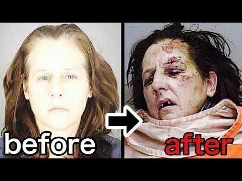 覚醒剤中毒者 使用前後の顔の変化がよくわかる動画 【衝撃】