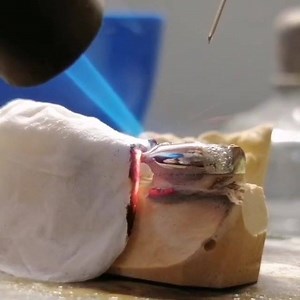 👉🏼Soldadura Video📹: @avanzadadental | Dental IQ