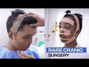 Incredible Craniofacial Transformation: Witnessing a Rare Surgical Case