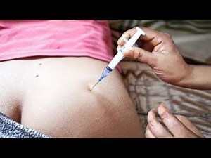 IM Intramuscular injection Push in the Buttocks Ceftriaxone 500mg & Dexamethasone ventrogluteal