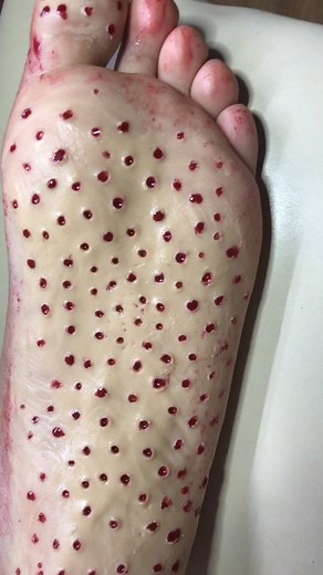 ⚠️TRIPOFOBIA⚠️ #makeup #maquillaje #tripofobia #tripofobiamakeup #sfxmakeup #sfx #fakeblood #gore #uruguay