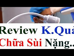 Anal Genital Warts in Men? Early Signs You Must Know! ⚠️