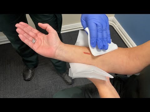 How to treat minor cuts and grazes at home