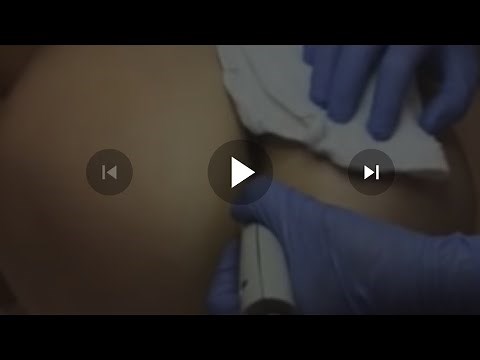 Vaginal ,Anal, Scrotum Area: Hygiene Benefits Of Laser Hair Removal.