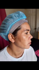 Tratamiento Anti Manchas. Estamos en Nicaragua. Managua y Estelí. Escribenos para más información. Whatsapp: 8387 4295 | Women Side Nicaragua | Facebook