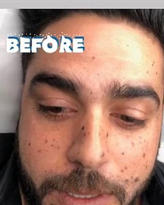 Aesthetica for men Combination of Waax organic 淋 Tweezing ✂️ & over 26 years of experience #amazing #eyebrows #eyebrow #alabama #miami #Aventura#men #masterpiece #master #love #lovemyjob #dreyebrows | Dr. Eyebrows | Facebook