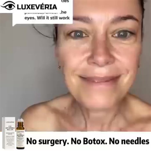 ✨ Clinically proven and dermatologist tested, Luxevéria® 10s Wrinkle Serum instantly lifts, smooths, and hydrates skin in just 10 seconds — no needles, no waiting, just visibly younger, firmer, radiant skin. https://www.quivyaussies.com/eyeantiwrinklerollingballswhite_en/bearings1 | Parkour en Matamoros/Movement urban freerun