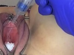 Female catheter tutorial