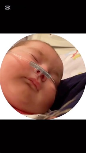 𝑁𝑎𝑡𝑢𝑟𝑎𝑙’𝑛𝑜𝑒 𝑙𝑒𝑐ℎ𝑒𝑛𝑖𝑒 | 𝐹𝑜𝑜𝑑 𝑏𝑙𝑜𝑔𝑔𝑒𝑟 | 𝐿𝑖𝑓𝑒𝑠𝑡𝑦𝑙𝑒 on Instagram: "1. Yallig‘lanishga qarshi va tinchlantiruvchi ta’sir • Og‘iz, tomoq, halqum va o‘pka kasalliklarida padarojnik shilliq qavatni yumshatadi va tiklaydi. • Ayniqsa laringit, bronxit, quruq yo‘talda tavsiya etiladi. 2. Qon to‘xtatuvchi xossasi • Yaraga qo‘yilganda yoki ichki qon ketishda (qon aralash balg‘am, hayz kuchayishi) qon ketishini to‘xtatadi. • Yangi barglarini ezib, to‘g‘ridan-to‘g‘ri yara u