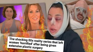 Plastic Surgery Makeover Show GONE WRONG: The BOTCHED Surgeries Behind The Swan #theswan #plasticsurgery #plasticsurgerybeforeandafter #plasticsurgerygonewrong #realitytvdrama | Sloan Hooks