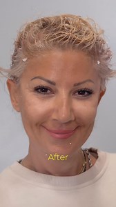 The @petliftface is versatile and very convenient!!! DM us today for your free consultation | CG Cosmetic Surgery