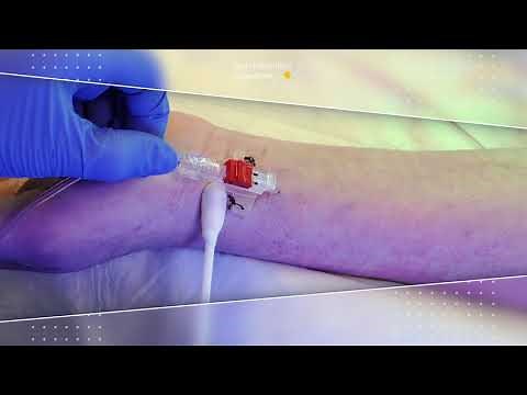 Arterie Verbandswechsel - Tutorial Bezirkskliniken Schwaben