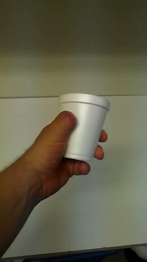 Thumb Amputee, 1 Month after Amputation