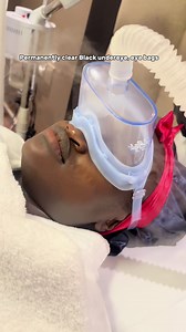 Eye Bag & Dark Spot Massage Therapy for Hyperpigmentation