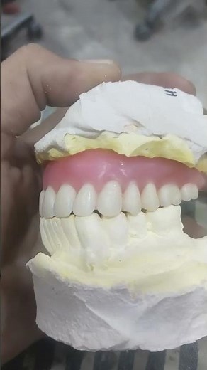Teeth Arrangement Of Upper Complete Denture 😁😁😁