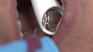 Zeg hallo tegen minder aerosolen, flexibele HVE-slang, 360 ° draaibaar en beter zicht… alles in één hand. Purevac® HVE System. Spiegel en afzuigsysteem in 1. Meer informatie? Ga naar http://ms.spr.ly/6188VrjTK | Dentsply Sirona