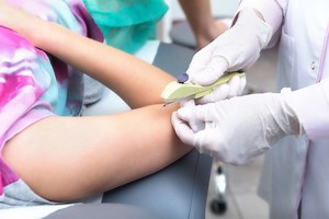 Définition | Implant contraceptif : qu'est-ce que c'est ? | Futura santé