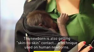 152K views · 3.9K reactions | This adorable gorilla baby was born by a rare C-section delivery. | CBC News | Facebook