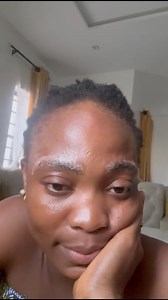 13K views · 11 reactions | 1 week post microblading removal Scabs are gone, redness has settled, and the skin is regenerating beautifully. Healing is a process trust it and trust deskinculture #deskinculture | Chinelo Stella | Facebook