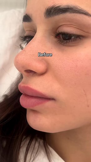 Does this sound familiar? ❌ Your pores always look clogged no matter how much you wash your face. ❌ Blackheads keep coming back even after scrubs and pore strips. ❌ Professional facials are expensive and often uncomfortable. The reality is, many people struggle with stubborn pores and uneven skin texture because traditional methods don’t actually remove impurities from deep within the skin. Many believe harsh scrubs or painful extractions are the only way to get clean pores—but that’s simply not