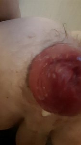 Upside down inside out prolapse play