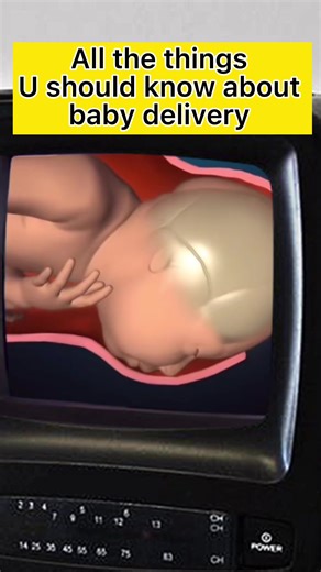 #babyborn #fpy #babybirth