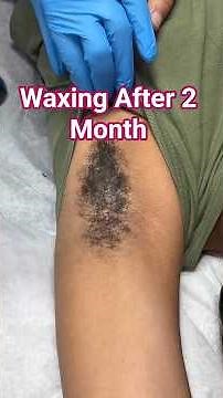 Waxing After 2 Month