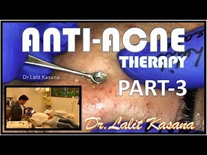 BLACKHEAD EXTRACTION PART 3 BY DR LALIT KASANA