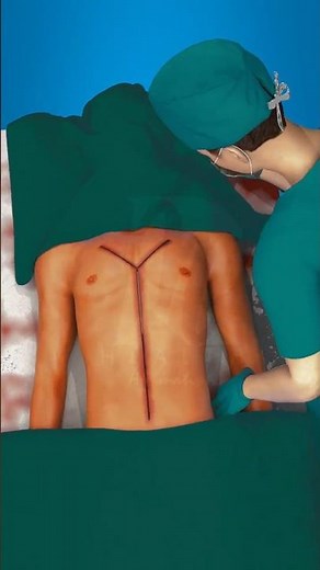 Autopsy or Postmortem Process #postmortem