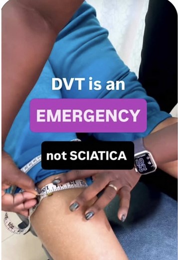 Identifying Deep Vein Thrombosis Symptoms Early