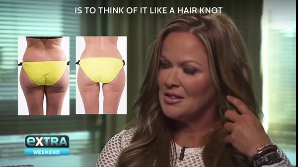 The BigDaddy FasciaBlaster by Ashley Black. Two Extra Claws than the Original FasciaBlaster. Great for Bigger Guys and Gals. Perfect for your Back. Deep Muscle Refief and Anti-Cellulite