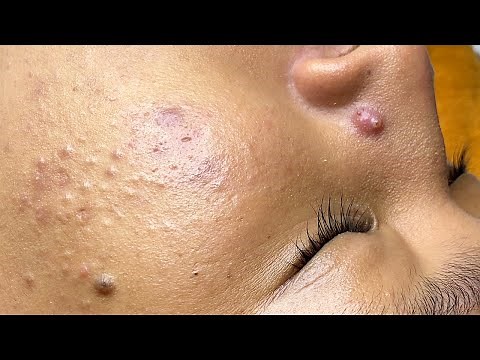 Relax Every Day With Sac Dep Spa #0149