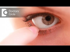 What are the symptoms of a Stye? - Dr. Sunita Rana Agarwal