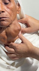 871K views · 9.4K reactions | This lady with advanced stage thyroid tumor was not affording. The relative brought her to me for treatment at Quaid e Azam International hospital Islamabad... She was advised workup to be operated on next list INSHAALLAH | Dr Bakht Zada | Facebook