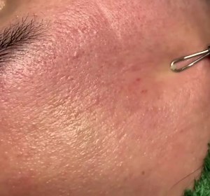 What does an ultrasonic skin scrubber do? ￼ The skin scrubber utilizes ultrasound technology to gently exfoliate the skin of dead skin cells and impurities. Ultrasonic waves help loosen and remove oil, dirt and cellular debris from pores in order to achieve a noticeably radiant, healthy glow. | Face and Body Therapy Perth Australia