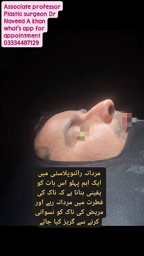 #MaleRhinoplasty #NoseSurgery #FacialSurgery #CosmeticSurgery #PlasticSurgery #MenBeauty #NoseJob #FacialEnhancement #SelfConfidence #CosmeticProcedure #NoseReshaping #MenAesthetics #BeYourBestSelf #SurgicalTransformation #RhinoplastyJourney #MenHealth #FacialHarmony #PlasticSurgeryResults #BeautyEnhancement #SurgicalMakeover | Dr Naveed A Khan Plastic Surgeon