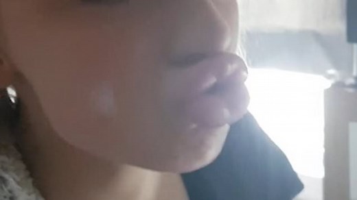 Kylie Jenner lip challenge goes wrong for teen girl