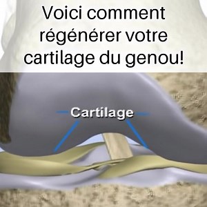 Voici comment régénérer votre cartilage du genou! (lien en commentaire) | Les choses les plus stupides à faire