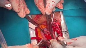 O cirurgião que faz "milagres no coração" dos angolanos