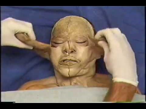 Forensic Medicine: Human Head and Neck Dissection Explained in Details Part-1