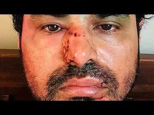 I Got Attacked in America