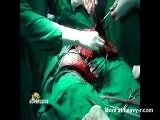 male ball sack cut open testicles removed Videos