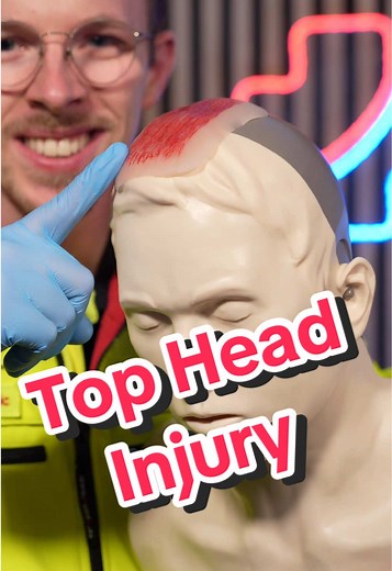 Head Bandage for Top-of-Head Injuries 🤕🚑 Bleeding from the top of the head can be tricky to manage. This technique helps you secure a dressing properly and keep it in place. 1️⃣ Protect yourself, wear gloves if available 2️⃣ Place a sterile dressing directly on the wound 3️⃣ Use two bandages: • One goes around the head continuously • The second is fixed after the first wrap and then guided over the top of the head at a 90° angle, back and forth 4️⃣ Continue until the dressing is fully secured,
