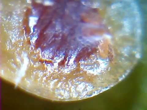 Scale Insect - Coccidae