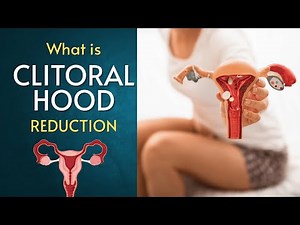 Clitoral Hood Reduction Explained: Procedure, Benefits, Risks & Recovery | Intimate Health